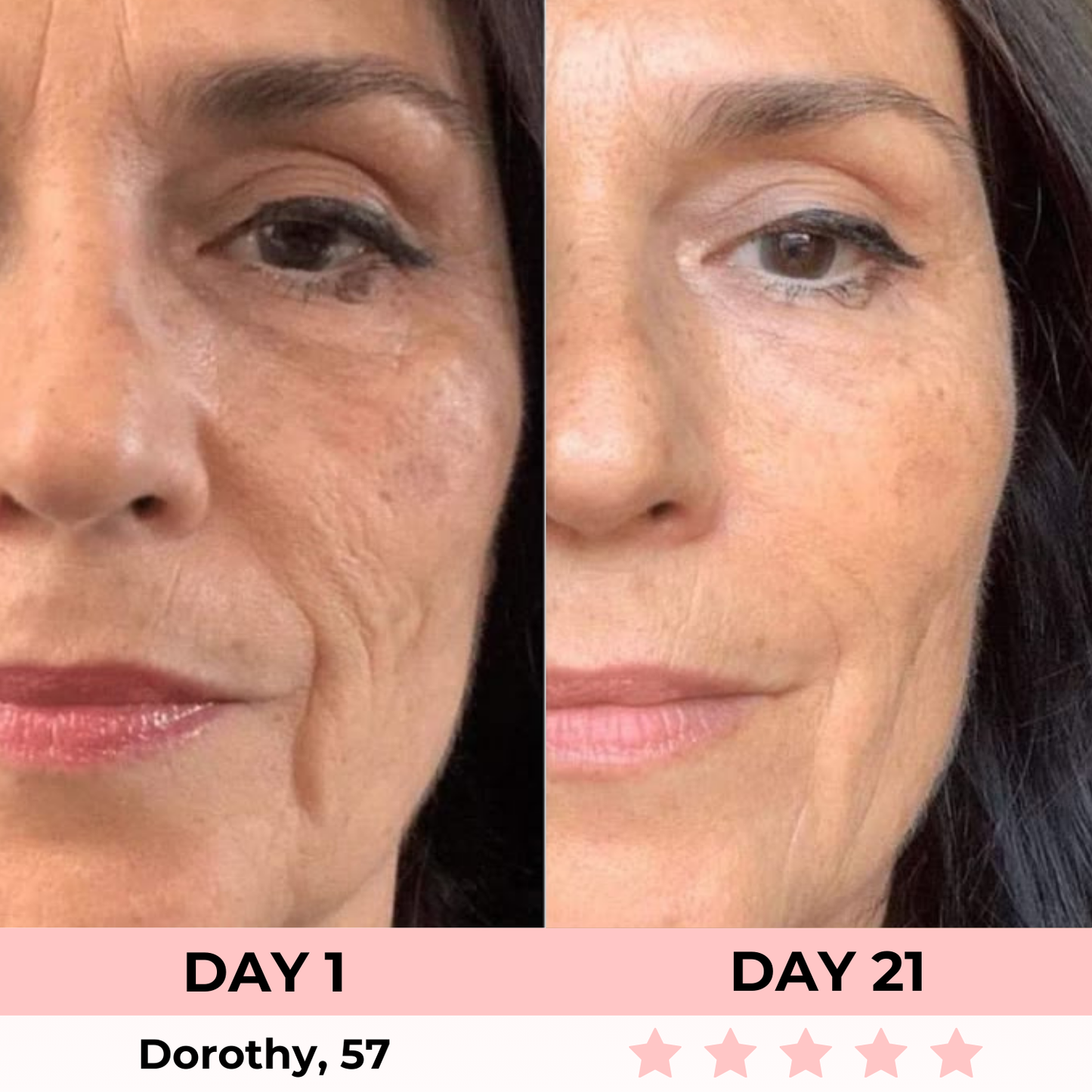 Lux Cove Kojic Acid Overnight Collagen Mask
