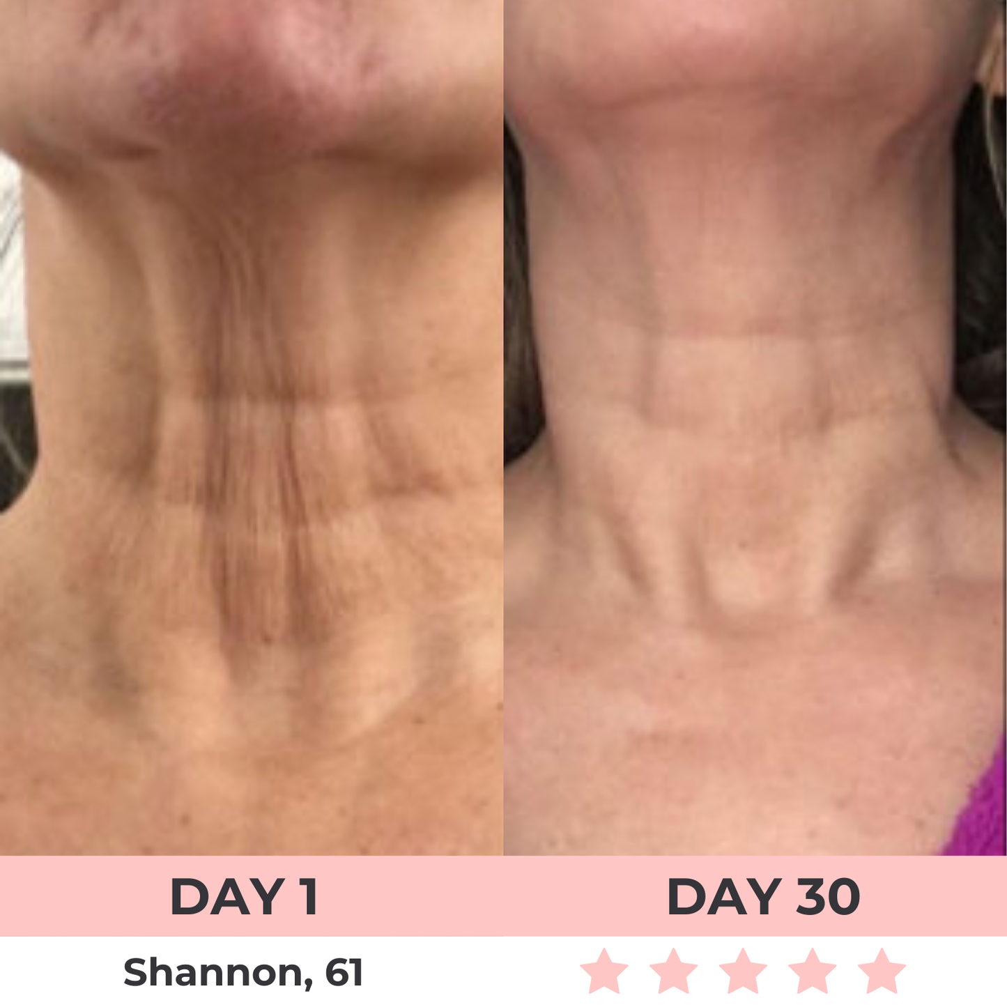 Lux Cove 7-in-1 LED Facial Sculptor