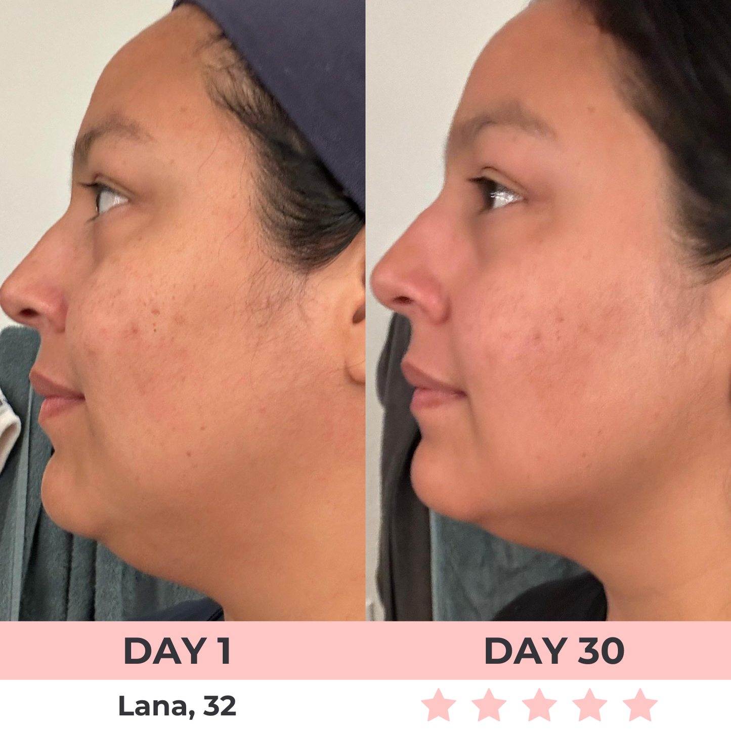 Lux Cove 7-in-1 LED Facial Sculptor