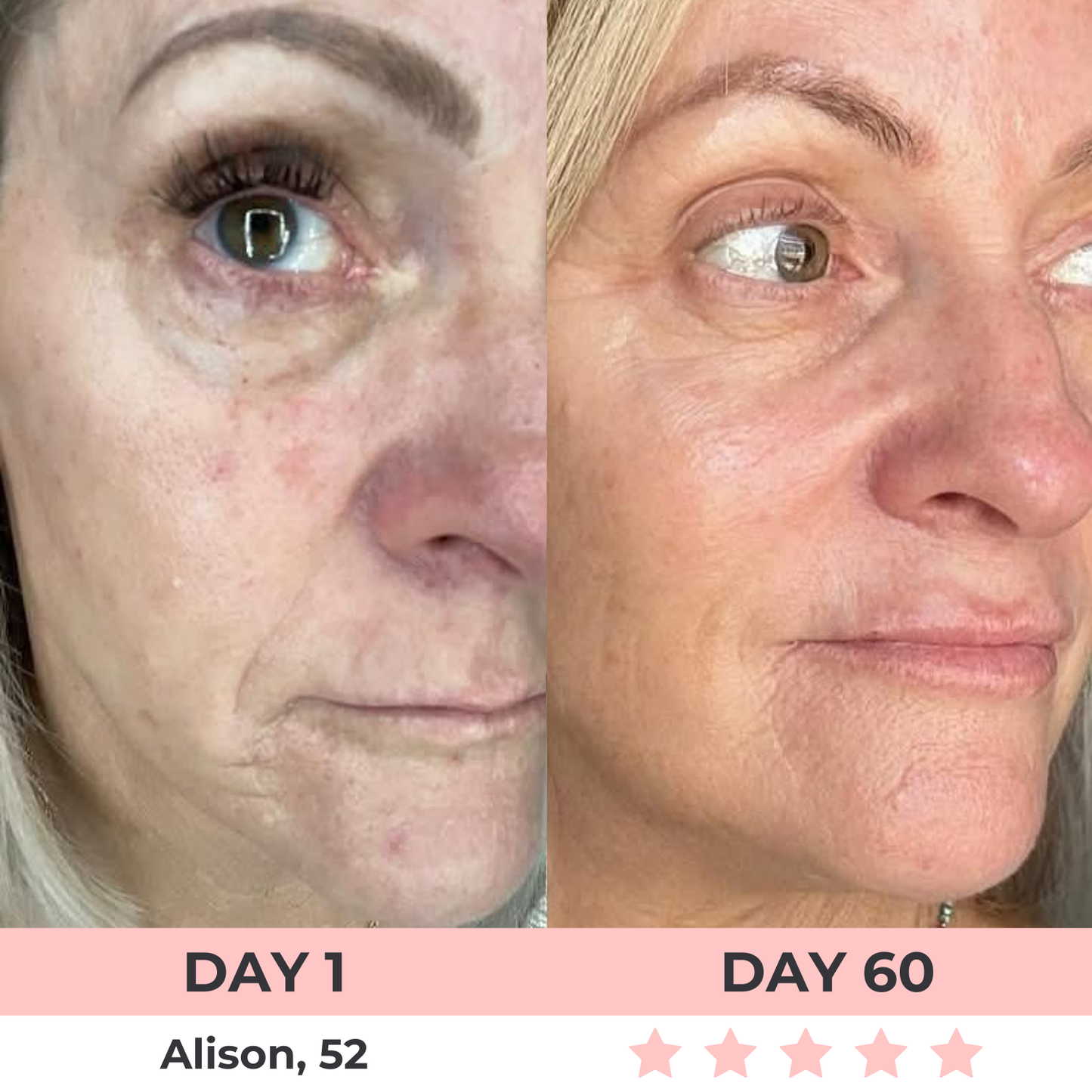 Lux Cove 7-in-1 LED Facial Sculptor