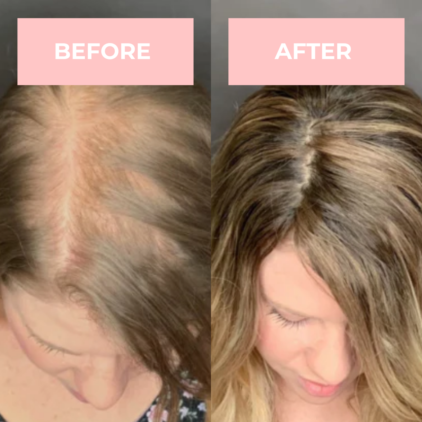 Lux Cove High Frequency Therapy Wand