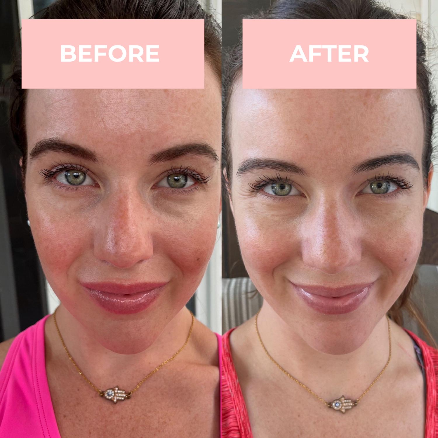 Lux Cove LED Face Mask