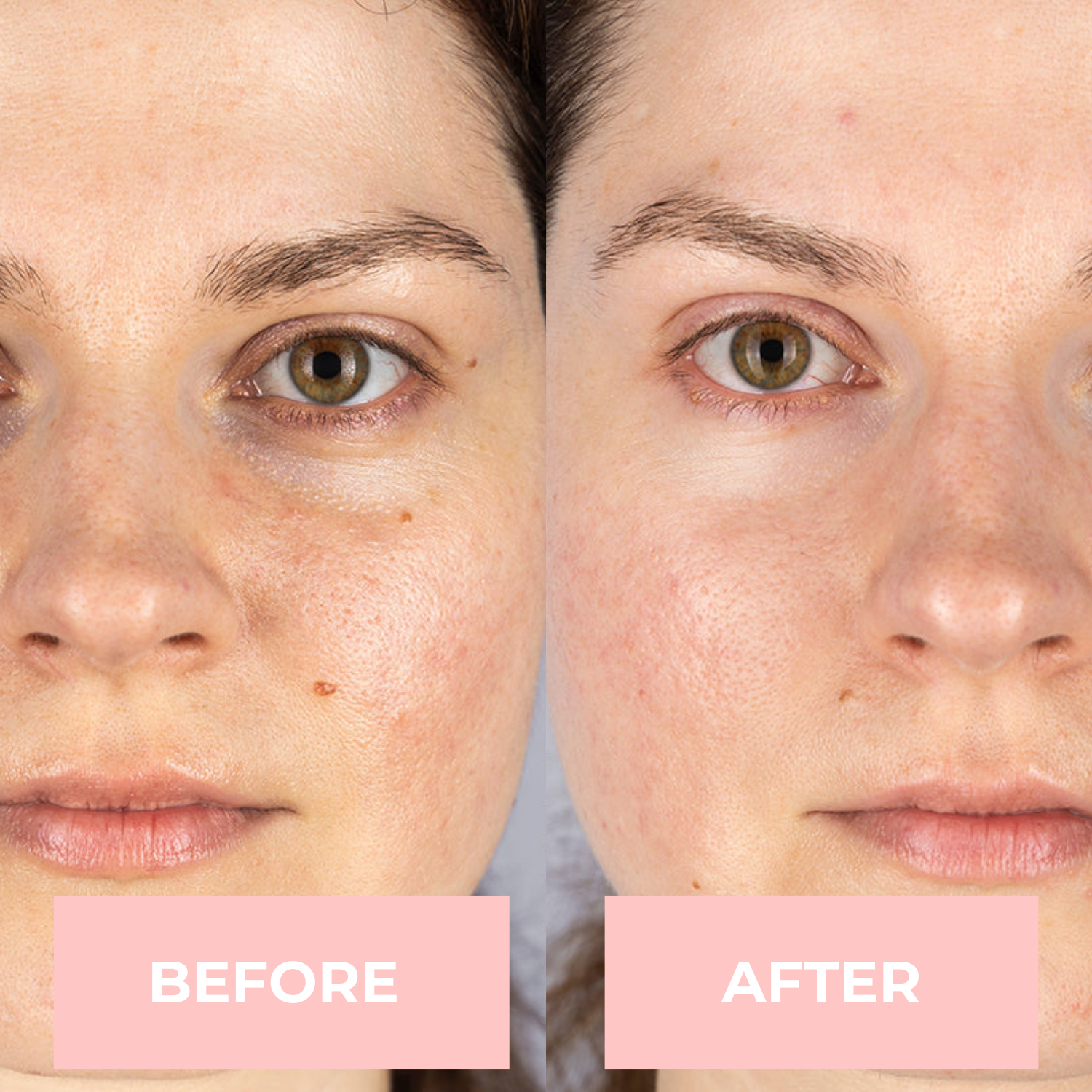 Lux Cove LED Face Mask
