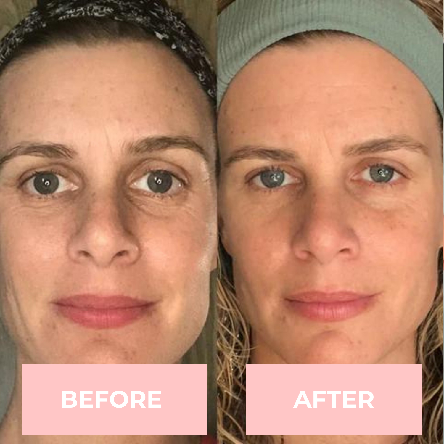Lux Cove LED Face Mask