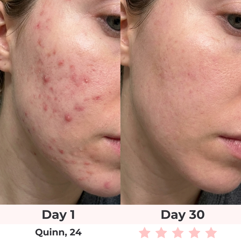Customer result