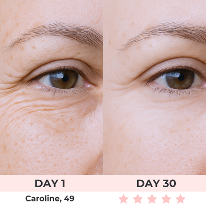 7-in-1 LED Facial Sculptor