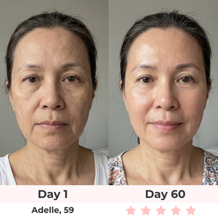 Lux Cove 7-in-1 LED Face Mask