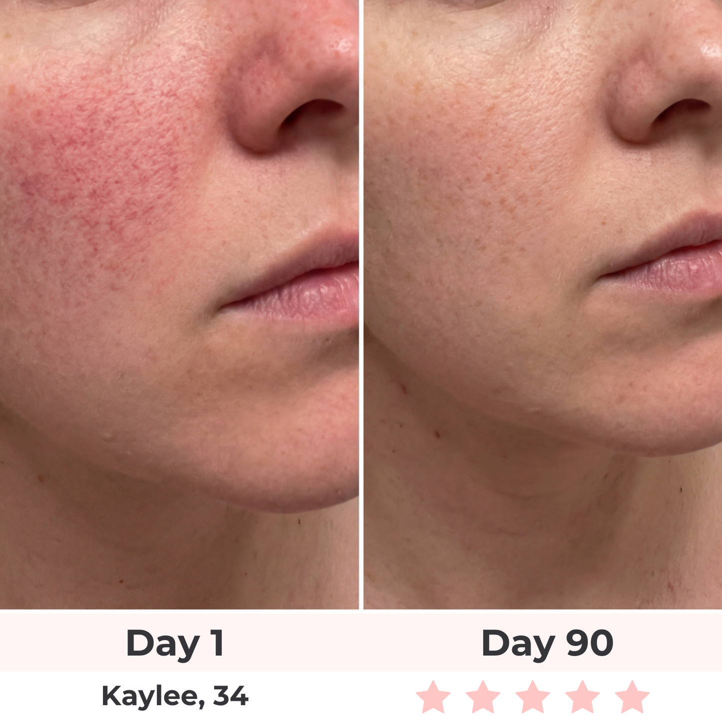 Lux Cove 7-in-1 LED Face Mask