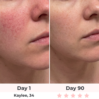 Lux Cove 7-in-1 LED Face Mask