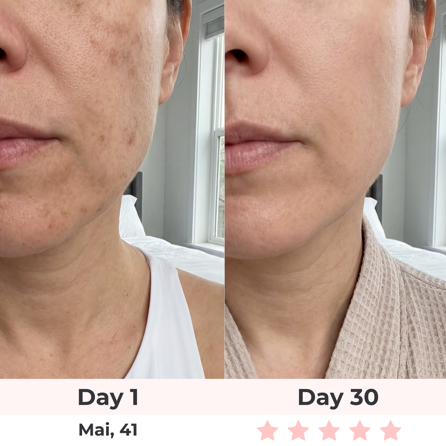 Lux Cove 7-in-1 LED Face Mask