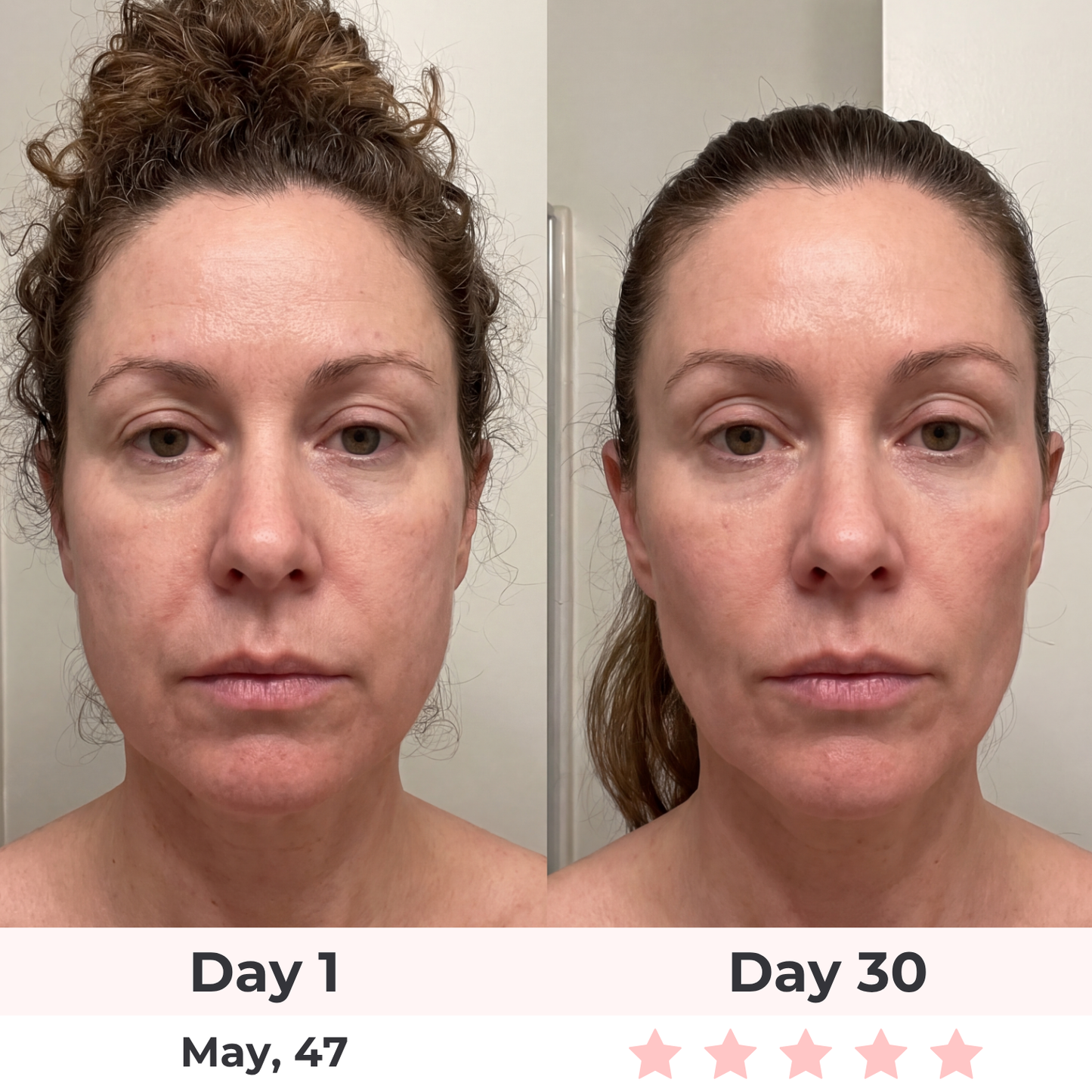 The Complete Lift & Glow Kit