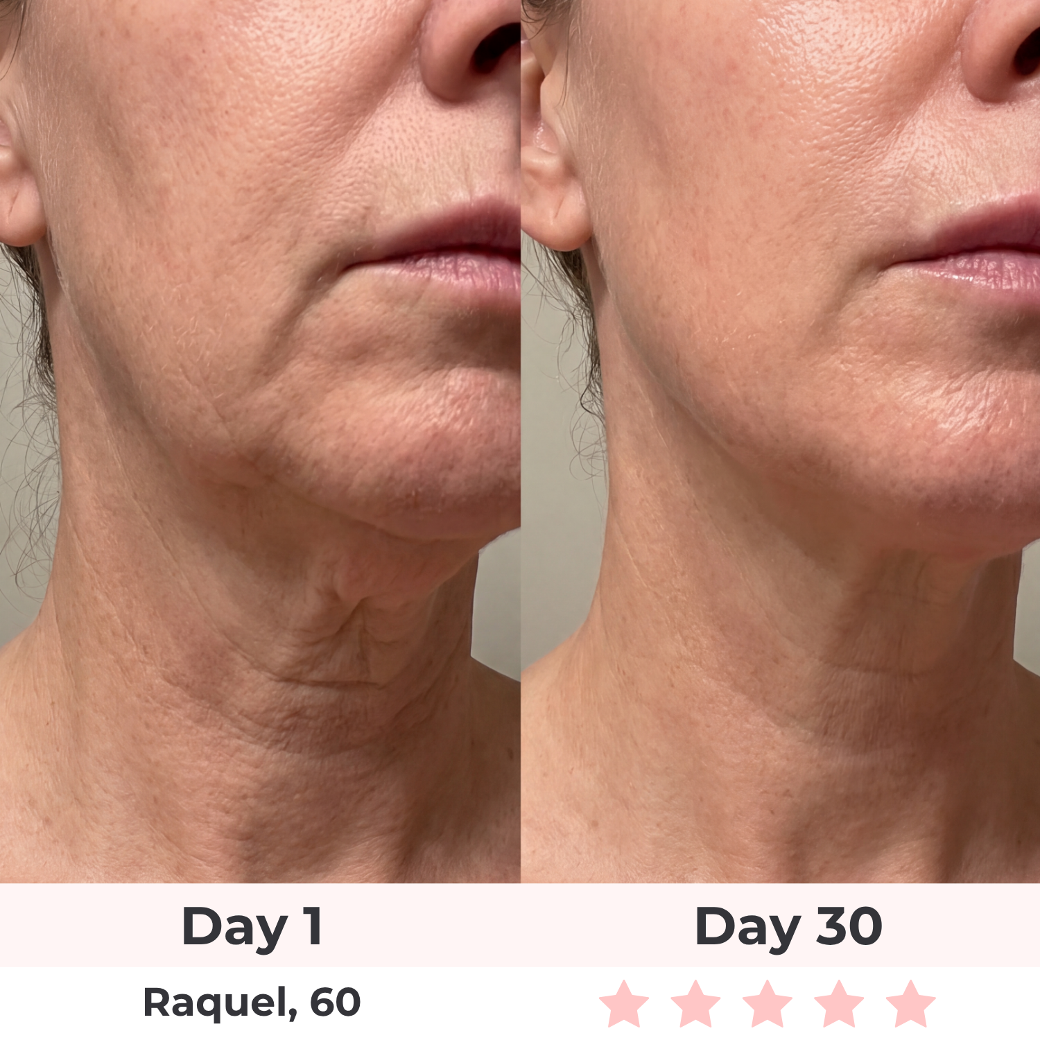 Lux Cove 7-in-1 LED Facial Sculptor