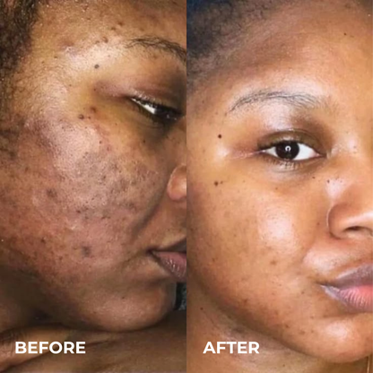 Alpha Arbutin + TXA Cream