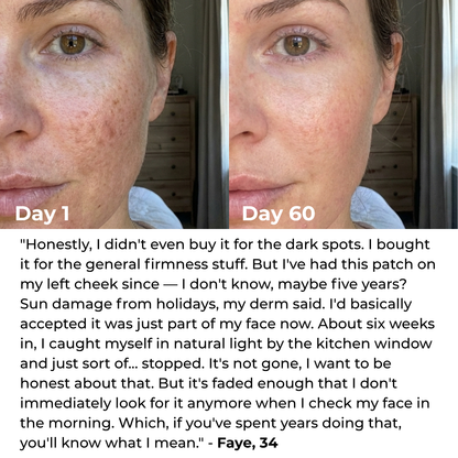 The Complete Lift & Glow Kit