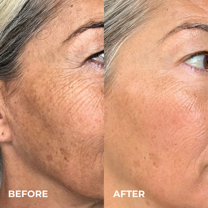 Alpha Arbutin + TXA Cream