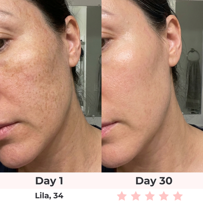 The Complete Lift & Glow Kit