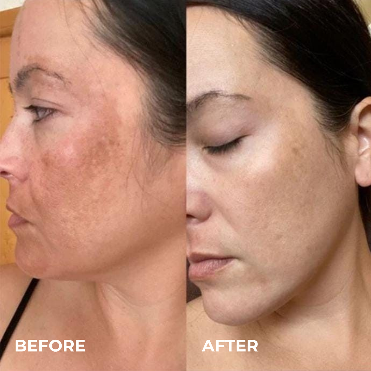 Alpha Arbutin + TXA Cream
