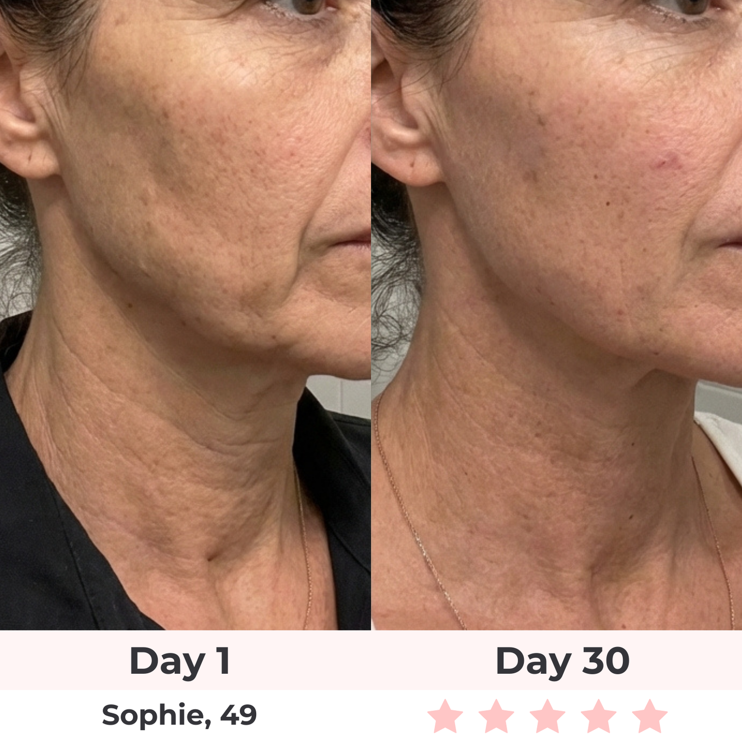 Lux Cove 7-in-1 LED Facial Sculptor