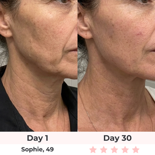 Lux Cove 7-in-1 LED Facial Sculptor