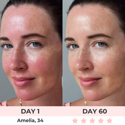 Lux Cove 7-in-1 LED Face Mask