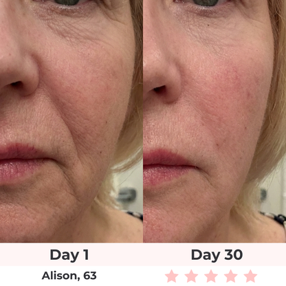 Lux Cove 7-in-1 LED Facial Sculptor