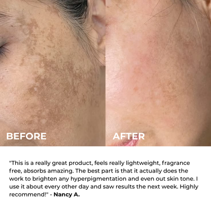 Alpha Arbutin + TXA Cream
