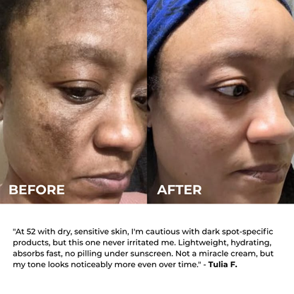 Alpha Arbutin + TXA Cream