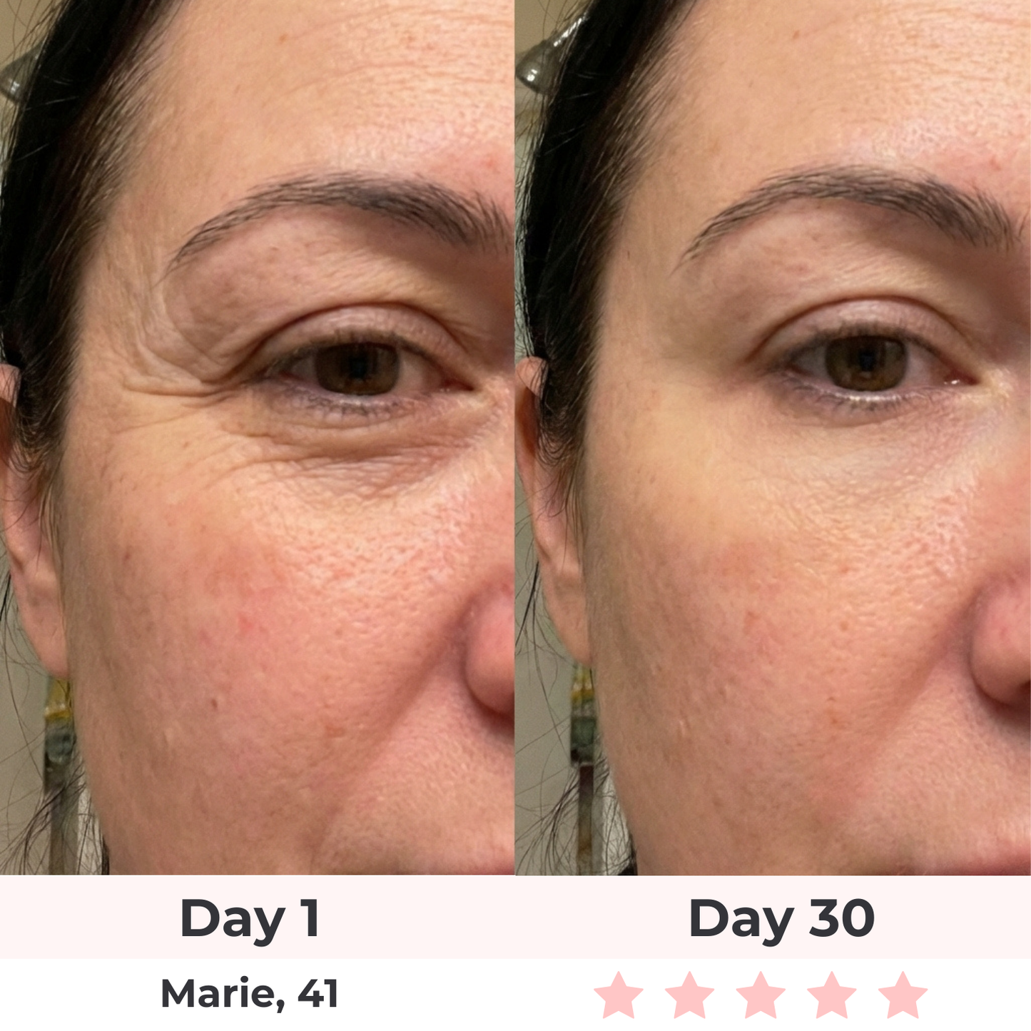 The Complete Lift & Glow Kit