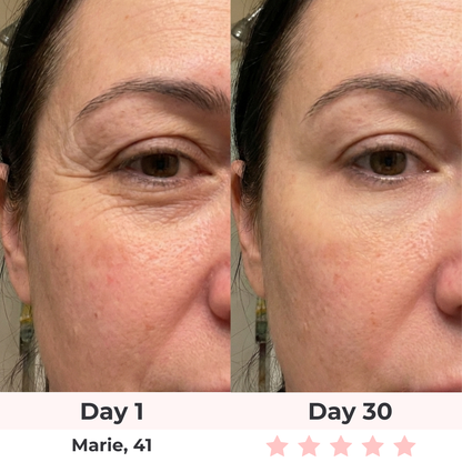 The Complete Lift & Glow Kit